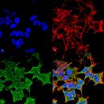 LGI1 Monoclonal Antibody (N283/7), PE