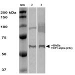 TCP1 Antibody in Western Blot (WB)