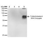 7-Ketocholesterol Monoclonal Antibody (7E1), PE