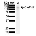 DIAPH2 Antibody in Western Blot (WB)