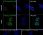 Phospho-ATR (Thr1989) Recombinant Rabbit Monoclonal Antibody (PS01-18)