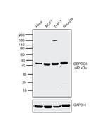 DEPDC6 Antibody in Western Blot (WB)