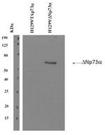 p73 delta Monoclonal Antibody (DNp73-1.1)
