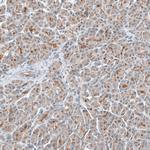 TMPRSS2 Antibody in Immunohistochemistry (Paraffin) (IHC (P))