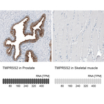 TMPRSS2 Antibody in Immunohistochemistry (Paraffin) (IHC (P))