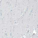 TMPRSS2 Antibody in Immunohistochemistry (Paraffin) (IHC (P))