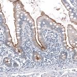 TMPRSS2 Antibody in Immunohistochemistry (Paraffin) (IHC (P))