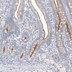 TMPRSS2 Antibody in Immunohistochemistry (Paraffin) (IHC (P))