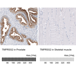 TMPRSS2 Monoclonal Antibody (CL12514)