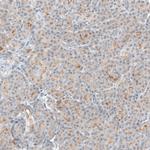 TMPRSS2 Antibody in Immunohistochemistry (Paraffin) (IHC (P))