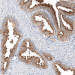 TMPRSS2 Antibody in Immunohistochemistry (Paraffin) (IHC (P))