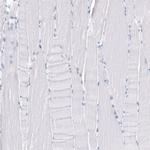 TMPRSS2 Antibody in Immunohistochemistry (Paraffin) (IHC (P))