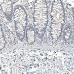 FOXL2 Antibody in Immunohistochemistry (Paraffin) (IHC (P))