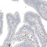 FOXL2 Antibody in Immunohistochemistry (Paraffin) (IHC (P))