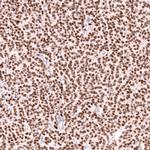 FOXL2 Antibody in Immunohistochemistry (Paraffin) (IHC (P))