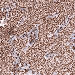FOXL2 Antibody in Immunohistochemistry (Paraffin) (IHC (P))
