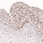 FOXL2 Antibody in Immunohistochemistry (Paraffin) (IHC (P))