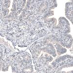 FOXL2 Antibody in Immunohistochemistry (Paraffin) (IHC (P))