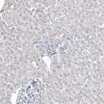 FOXL2 Antibody in Immunohistochemistry (Paraffin) (IHC (P))