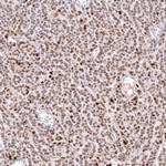 FOXL2 Antibody in Immunohistochemistry (Paraffin) (IHC (P))