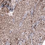 FOXL2 Antibody in Immunohistochemistry (Paraffin) (IHC (P))