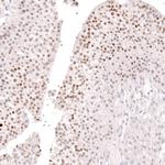 FOXL2 Antibody in Immunohistochemistry (Paraffin) (IHC (P))
