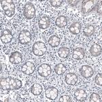 FOXL2 Antibody in Immunohistochemistry (Paraffin) (IHC (P))