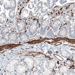 CD146 Antibody in Immunohistochemistry (Paraffin) (IHC (P))