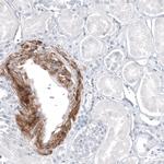 CD146 Antibody in Immunohistochemistry (Paraffin) (IHC (P))