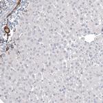 CD146 Antibody in Immunohistochemistry (Paraffin) (IHC (P))