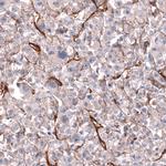 CD146 Antibody in Immunohistochemistry (Paraffin) (IHC (P))