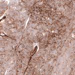 CD146 Antibody in Immunohistochemistry (Paraffin) (IHC (P))