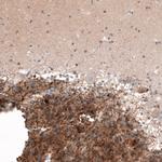 Calretinin Antibody in Immunohistochemistry (Paraffin) (IHC (P))
