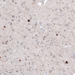 Calretinin Antibody in Immunohistochemistry (Paraffin) (IHC (P))