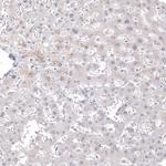 Calretinin Antibody in Immunohistochemistry (Paraffin) (IHC (P))