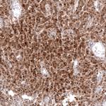 Calretinin Antibody in Immunohistochemistry (Paraffin) (IHC (P))
