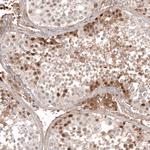 Calretinin Antibody in Immunohistochemistry (Paraffin) (IHC (P))