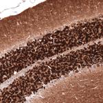 Calretinin Antibody in Immunohistochemistry (Paraffin) (IHC (P))