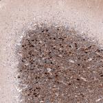 Calretinin Antibody in Immunohistochemistry (Paraffin) (IHC (P))