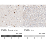 Calretinin Monoclonal Antibody (CL12842)