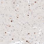 Calretinin Antibody in Immunohistochemistry (Paraffin) (IHC (P))