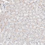 Calretinin Antibody in Immunohistochemistry (Paraffin) (IHC (P))
