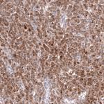 Calretinin Antibody in Immunohistochemistry (Paraffin) (IHC (P))