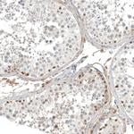 Calretinin Antibody in Immunohistochemistry (Paraffin) (IHC (P))