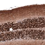 Calretinin Antibody in Immunohistochemistry (Paraffin) (IHC (P))