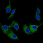 Melan-A Monoclonal Antibody (CL12863)