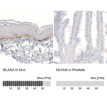 Melan-A Antibody in Immunohistochemistry (Paraffin) (IHC (P))