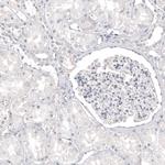 Melan-A Antibody in Immunohistochemistry (Paraffin) (IHC (P))