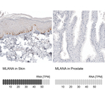 Melan-A Antibody in Immunohistochemistry (Paraffin) (IHC (P))