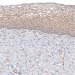 WFDC2 Antibody in Immunohistochemistry (Paraffin) (IHC (P))